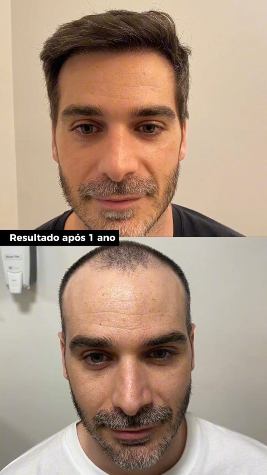 uploads/frames pro hair(6).png